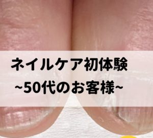 京都トラブル爪の写真