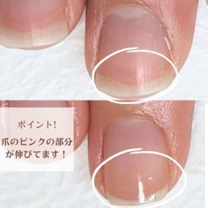 京都爪の写真