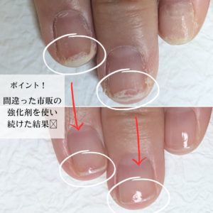 京都二枚爪の写真