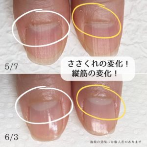 京都府爪の写真