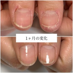 自爪育成京都画像