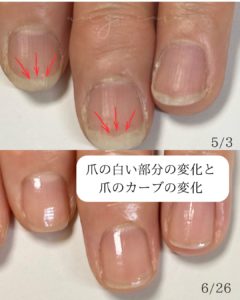 長岡京深爪画像