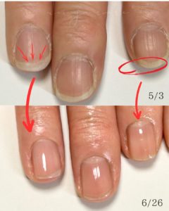 自爪育成長岡京画像