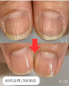 長岡京爪育画像