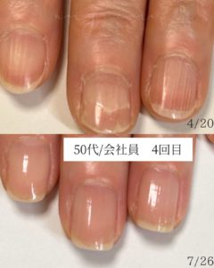 長岡京自爪育成画像