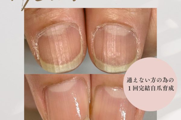 サロンに通うのは難しいけれど、自分の爪を育てたい方へ