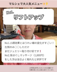 京都耳つぼジュエリー画像