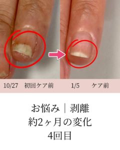長岡京ネイルケア画像