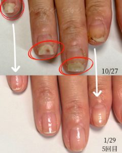 京都育爪サロン画像