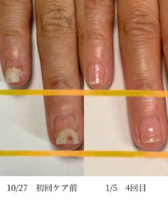 京都ネイルケア画像
